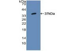 Detection of Recombinant IRF1, Human using Polyclonal Antibody to Interferon Regulatory Factor 1 (IRF1) (IRF1 抗体  (AA 11-276))
