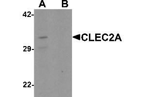 Western blot analysis of CLEC2A in K562 cell lysate with CLEC2A antibody at 1 µg/mL in (A) the absence and (B) the presence of blocking peptide. (CLEC2A 抗体  (N-Term))