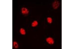 Immunofluorescent analysis of HNF4 alpha/gamma staining in HeLa cells. (HNF4 alpha/gamma 抗体)