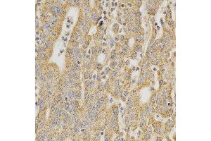 Immunohistochemistry (IHC) image for anti-DNA (Cytosine-5-)-Methyltransferase 3 alpha (DNMT3A) (AA 500-700) antibody (ABIN3022834)