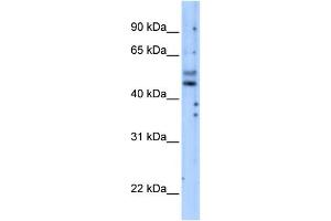 PIK3R3 antibody used at 5 ug/ml to detect target protein. (PIK3R3 抗体)