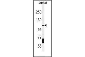 Western blot analysis of PDE3B Antibody (Center) in Jurkat cell line lysates (35ug/lane). (PDE3B 抗体  (Middle Region))