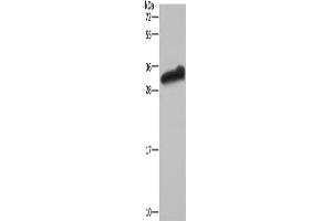 Western Blotting (WB) image for anti-Glutathione S-Transferase alpha 3 (GSTA3) antibody (ABIN2430213) (GSTA3 抗体)