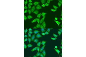 Immunofluorescence analysis of U2OS cells using PKR/PKR/EIF2 antibody (ABIN1679688 and ABIN3018462) at dilution of 1:100. (EIF2AK2 抗体)