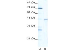 WB Suggested Anti-HSF4 Antibody Titration:  5. (HSF4 抗体  (Middle Region))