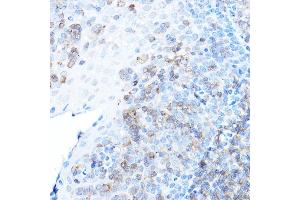Immunohistochemistry of paraffin-embedded human tonsil using ULBP1 Rabbit pAb (ABIN6128898, ABIN6149917, ABIN6149918 and ABIN6214755) at dilution of 1:500 (40x lens). (ULBP1 抗体  (AA 26-216))