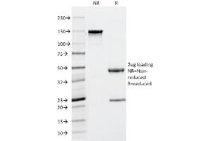 SDS-PAGE Analysis Purified Tryptase Mouse Monoclonal Antibody (TPSAB1/1963). (TPSAB1 抗体  (AA 115-233))