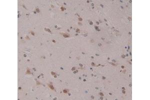 Used in DAB staining on fromalin fixed paraffin- embedded Kidney tissue (HOPX 抗体  (AA 10-73))