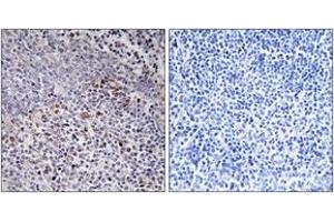 Immunohistochemistry analysis of paraffin-embedded human tonsil tissue, using Cytochrome c-type Heme Lyase Antibody. (HCCS 抗体  (AA 81-130))