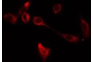 ABIN6275096 staining  COLO205 cells by IF/ICC.