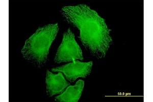 Immunofluorescence of monoclonal antibody to PGA5 on HeLa cell. (PGA5 抗体  (AA 203-306))