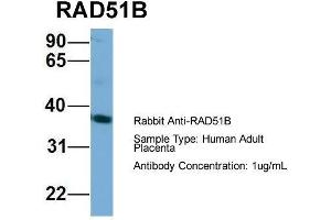 Western Blotting (WB) image for anti-RAD51 Homolog B (Rad51B) (Middle Region) antibody (ABIN2787357)