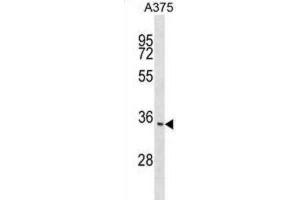 Western Blotting (WB) image for anti-Integral Membrane Protein 2C (ITM2C) antibody (ABIN2999274) (ITM2C 抗体)