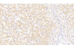 Immunohistochemistry (IHC) image for anti-Phospholipase A2, Group IVA (Cytosolic, Calcium-Dependent) (PLA2G4A) (AA 1-178) antibody (ABIN7437737)