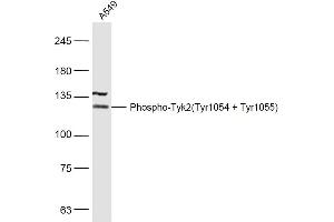 A549 lysates probed with Phospho-Tyk2(Tyr1054 + Tyr1055) Polyclonal Antibody, Unconjugated  at 1:500 dilution and 4˚C overnight incubation. (TYK2 抗体  (pTyr1054, pTyr1055))
