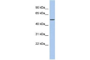 WB Suggested Anti-DALRD3 Antibody Titration: 0. (DALRD3 抗体  (Middle Region))