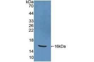 Detection of Recombinant PPARg, Human using Polyclonal Antibody to Peroxisome Proliferator Activated Receptor Gamma (PPARg) (PPARG 抗体  (AA 157-274))