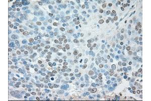 Immunohistochemical staining of paraffin-embedded Kidney tissue using anti-USP13mouse monoclonal antibody. (USP13 抗体)