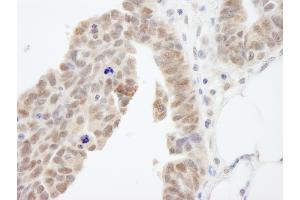 Immunohistochemistry (IHC) image for anti-Abl-Interactor 1 (ABI1) (AA 325-375) antibody (ABIN7453822)
