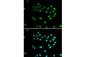Immunofluorescence analysis of A549 cell using SIRT1 antibody. (SIRT1 抗体)