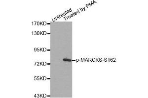 Western Blotting (WB) image for anti-Myristoylated Alanine-Rich Protein Kinase C Substrate (MARCKS) (pSer162) antibody (ABIN1870417) (MARCKS 抗体  (pSer162))