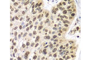 Immunohistochemistry (Paraffin-embedded Sections) (IHC (p)) image for anti-Septin 7 (SEPT7) antibody (ABIN7260851)