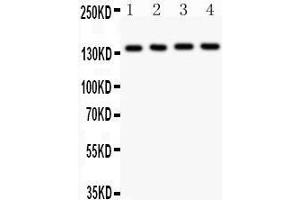 Anti- ABCB4 Picoband antibody, Western blotting All lanes: Anti ABCB4  at 0. (ABCB4 抗体  (AA 601-720))