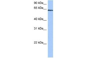 TTC6 antibody used at 0. (TTC6 抗体  (C-Term))