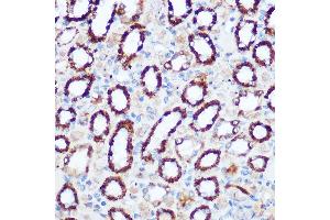 Immunohistochemistry of paraffin-embedded rat kidney using PDH Rabbit pAb (7432) at dilution of 1:100 (40x lens). (PDHA1 抗体)