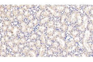 Immunohistochemistry (IHC) image for anti-Von Hippel-Lindau Tumor Suppressor, E3 Ubiquitin Protein Ligase (VHL) (AA 6-175) antibody (ABIN7441592)
