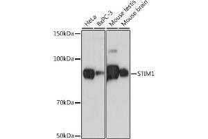 Western blot analysis of extracts of various cell lines, using STIM1 antibody (ABIN7270609) at 1:500 dilution. (STIM1 抗体)