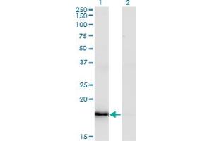 Western Blot analysis of ZMAT4 expression in transfected 293T cell line by ZMAT4 monoclonal antibody (M02), clone 2A4. (ZMAT4 抗体  (AA 1-153))