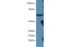 Western blot analysis of Mouse Serum, using Mouse C8b Antibody (2 µg/ml) and HRP-conjugated Goat Anti-Rabbit antibody ( (C8B 抗体  (AA 161-503))