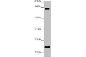Western blot All lanes: REEP1 antibody at 5. (Receptor Accessory Protein 1 抗体  (AA 101-201))