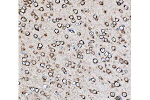 IHC analysis of MRPS25 using anti-MRPS25 antibody (ABIN7599032).