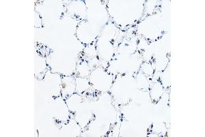 Immunohistochemistry of paraffin-embedded mouse lung using YE Rabbit pAb (ABIN6130808, ABIN6150331, ABIN6150332 and ABIN6221925) at dilution of 1:100 (40x lens). (GAS41 抗体  (AA 1-227))