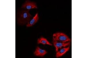 Immunofluorescent analysis of Beta-actin staining in A549 cells. (beta Actin 抗体)