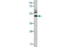 Western blot analysis of MDA-MB-435 cell lysate (35 ug/lane) with MMP16 polyclonal antibody . (MMP16 抗体  (N-Term))