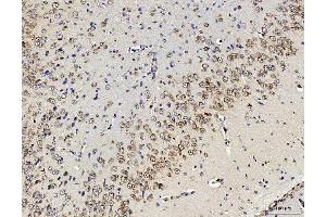 IHC analysis of RPL10 using anti-RPL10 antibody (ABIN7601177). (RPL10 抗体  (AA 3-214))