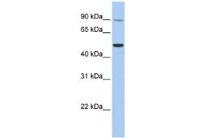 Western Blotting (WB) image for anti-Transient Receptor Potential Cation Channel, Subfamily V, Member 5 (TRPV5) (N-Term) antibody (ABIN633749)