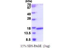 SDS-PAGE (SDS) image for Mitochondrial Ribosomal Protein L2 (MRPL2) (AA 84-202) protein (His tag) (ABIN5853998)