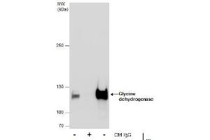 IP Image Immunoprecipitation of Glycine dehydrogenase protein from HepG2 whole cell extracts using 5 μg of Glycine dehydrogenase antibody [N3C2-2], Internal, Western blot analysis was performed using Glycine dehydrogenase antibody [N3C2-2], Internal, EasyBlot anti-Rabbit IgG  was used as a secondary reagent. (GLDC 抗体)