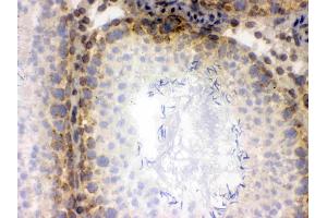 IHC analysis of CRM1 using anti-CRM1 antibody . (XPO1 抗体  (AA 966-1071))