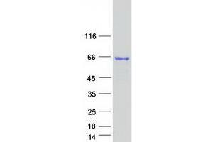 Arylsulfatase E Protein (ARSE) (Myc-DYKDDDDK Tag)