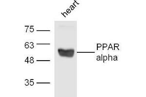 Western Blotting (WB) image for anti-Peroxisome Proliferator-Activated Receptor alpha (PPARA) (AA 301-400) antibody (ABIN701620)