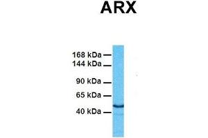 Host:  Rabbit  Target Name:  ARX  Sample Tissue:  Human Fetal Heart  Antibody Dilution:  1. (Arx 抗体  (Middle Region))