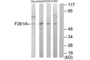 Western blot analysis of extracts from HeLa/HepG2/COLO205/293 cells, using PFKFB1/4 Antibody. (PFKFB1/4 抗体  (AA 331-380))