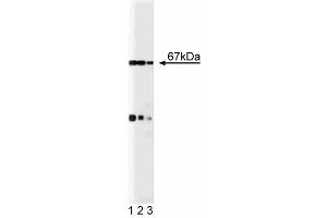 Western blot analysis of p67 [phox] on a EB1 cell lysate (Human B lymphoblast, Burkitt's lymphoma, ATCC HTB-60). (NCF2 抗体  (AA 317-469))