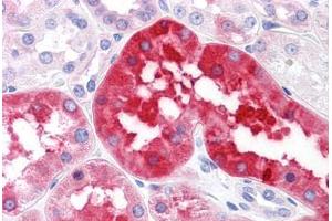 Human Kidney: Formalin-Fixed, Paraffin-Embedded (FFPE) (RNF144B 抗体  (AA 1-101))
