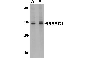 Western Blotting (WB) image for anti-arginine/serine-Rich Coiled-Coil 1 (RSRC1) (C-Term) antibody (ABIN1030630) (RSRC1 抗体  (C-Term))